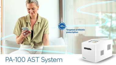 Riduzione tempi diagnosi con il sistema PA-100 AST di Sysmex