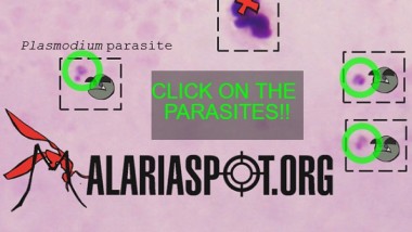 MalariaSpot: diagnosticare le malattie con i videogiochi