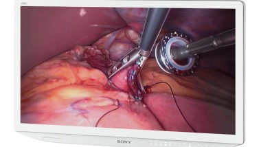 Le tecnologie 3D e 4K offrono una visualizzazione precisa in ambito medico 