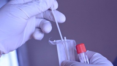 Un tampone per rilevare una particolare patologia cardiaca
