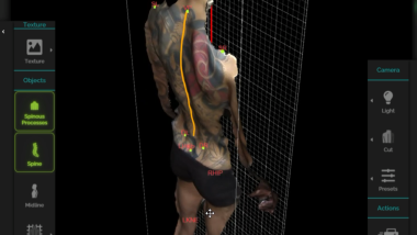 Spine3D Home: continuità terapeutica digitale