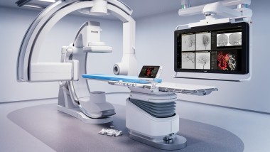 Philips: robotica e AI nella cura dell’ictus